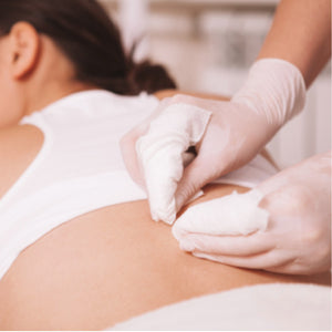 Limpieza o peeling espalda